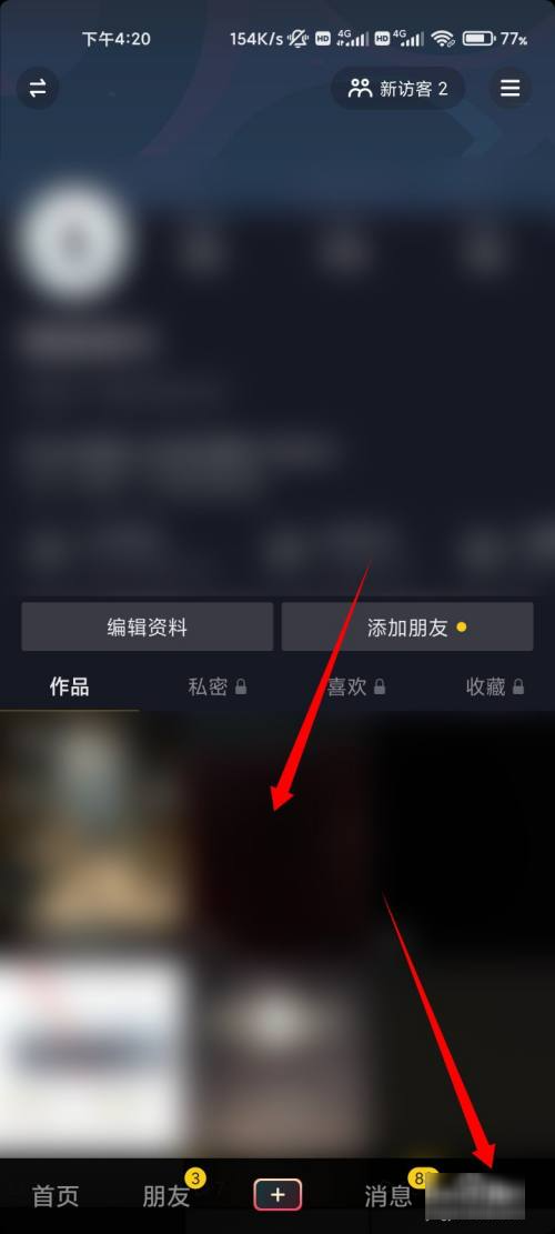 抖音怎么置顶自己视频