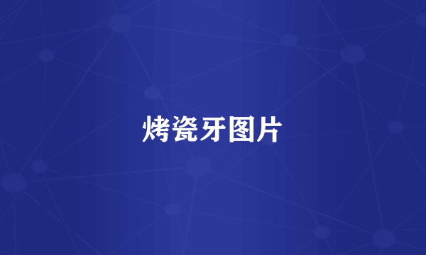烤瓷牙图片