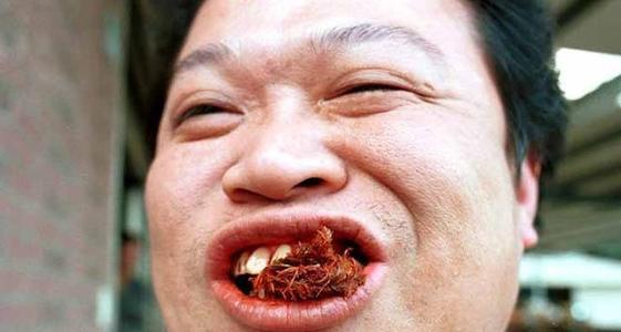 广州一小伙嚼槟榔一年后患口腔癌前病变，为什么嚼槟榔会导致口腔癌？
