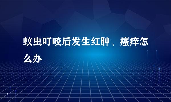 蚊虫叮咬后发生红肿、瘙痒怎么办
