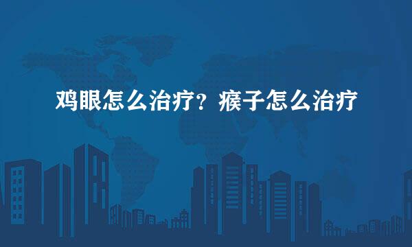 鸡眼怎么治疗？瘊子怎么治疗