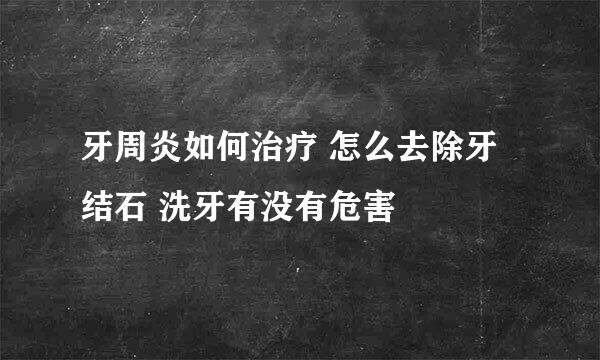 牙周炎如何治疗 怎么去除牙结石 洗牙有没有危害