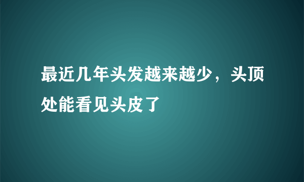 最近几年头发越来越少，头顶处能看见头皮了