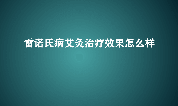 雷诺氏病艾灸治疗效果怎么样