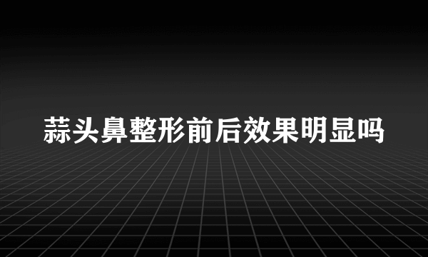 蒜头鼻整形前后效果明显吗