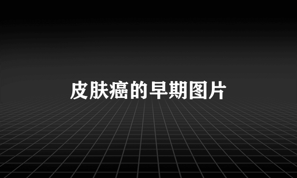 皮肤癌的早期图片