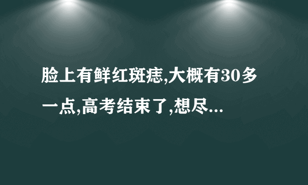 脸上有鲜红斑痣,大概有30多一点,高考结束了,想尽快去掉...