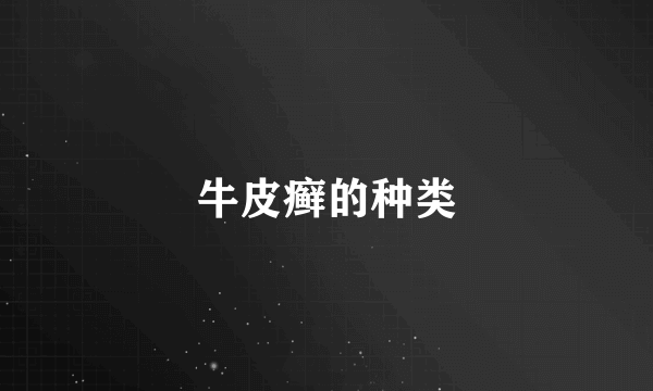 牛皮癣的种类