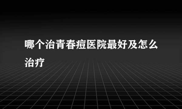 哪个治青春痘医院最好及怎么治疗