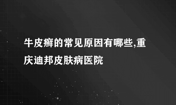 牛皮癣的常见原因有哪些,重庆迪邦皮肤病医院