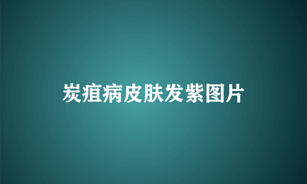 炭疽病皮肤发紫图片