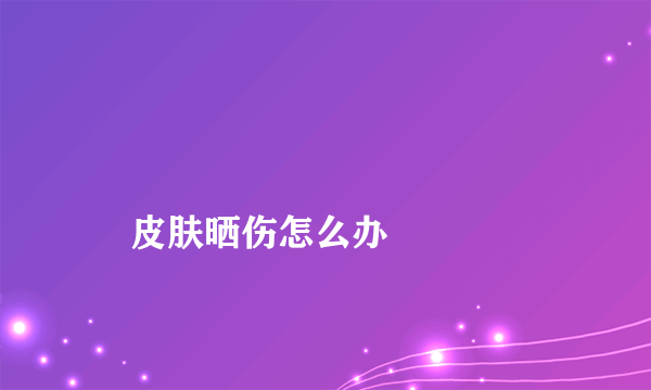 
    皮肤晒伤怎么办
  