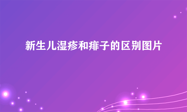 新生儿湿疹和痱子的区别图片