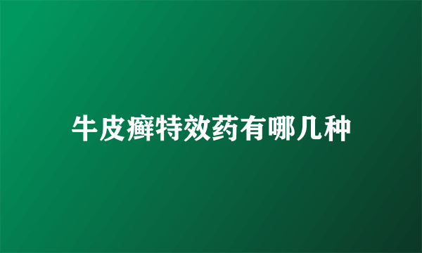 牛皮癣特效药有哪几种