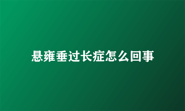 悬雍垂过长症怎么回事