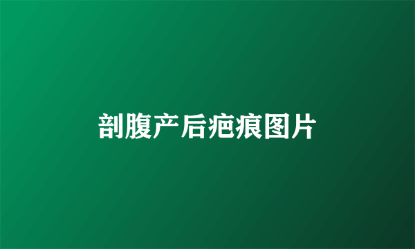 剖腹产后疤痕图片