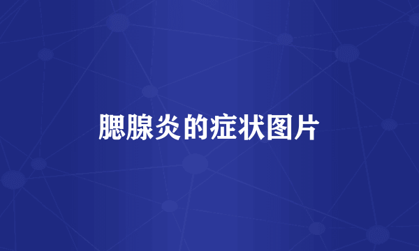 腮腺炎的症状图片