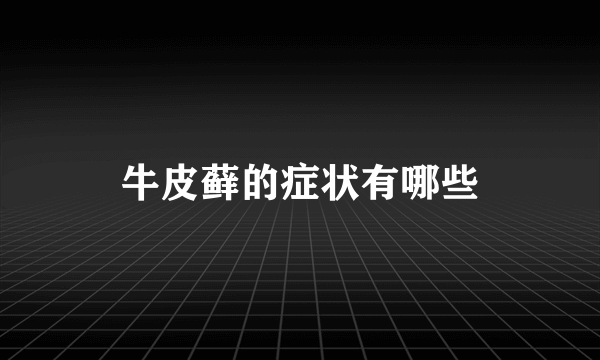 牛皮藓的症状有哪些