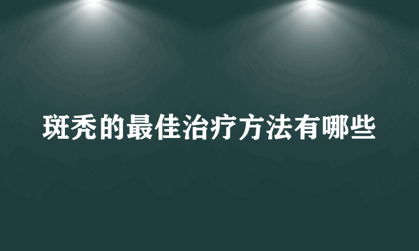 斑秃的最佳治疗方法有哪些