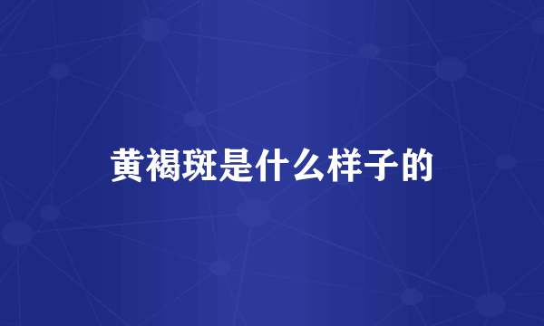 黄褐斑是什么样子的