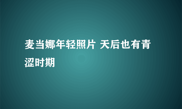 麦当娜年轻照片 天后也有青涩时期