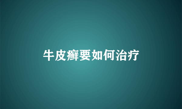 牛皮癣要如何治疗
