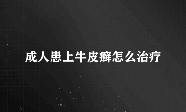 成人患上牛皮癣怎么治疗