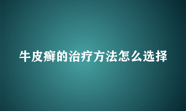 牛皮癣的治疗方法怎么选择