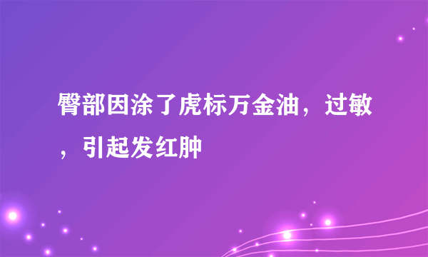 臀部因涂了虎标万金油，过敏，引起发红肿