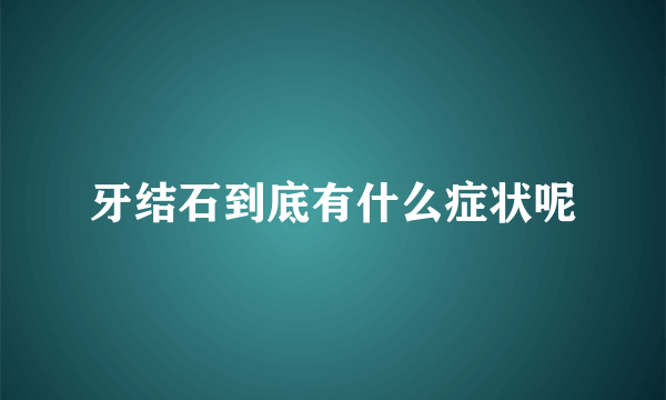 牙结石到底有什么症状呢