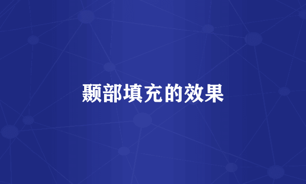 颞部填充的效果