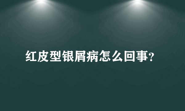 红皮型银屑病怎么回事？