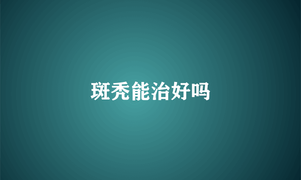 斑秃能治好吗