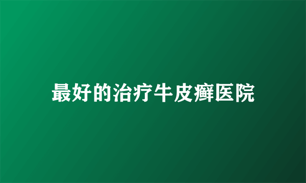 最好的治疗牛皮癣医院