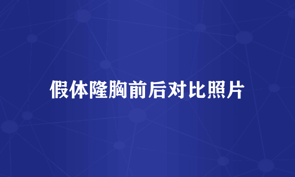 假体隆胸前后对比照片