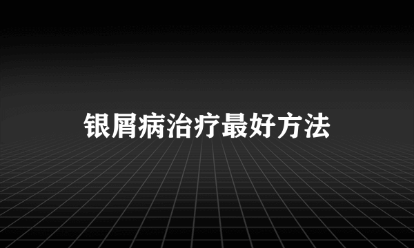 银屑病治疗最好方法