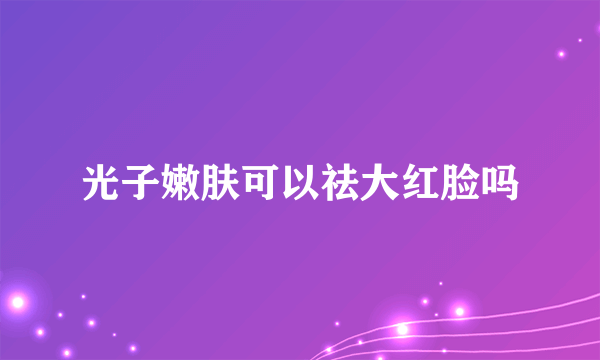 光子嫩肤可以祛大红脸吗