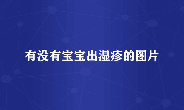 有没有宝宝出湿疹的图片