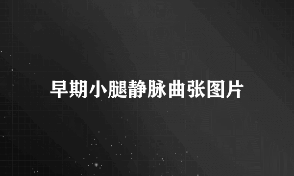 早期小腿静脉曲张图片