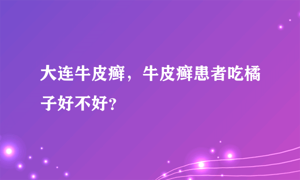大连牛皮癣，牛皮癣患者吃橘子好不好？