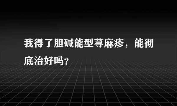 我得了胆碱能型荨麻疹，能彻底治好吗？