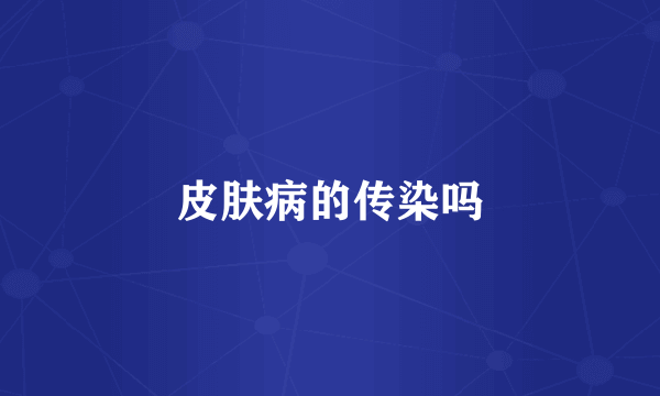 皮肤病的传染吗
