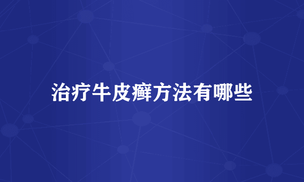 治疗牛皮癣方法有哪些