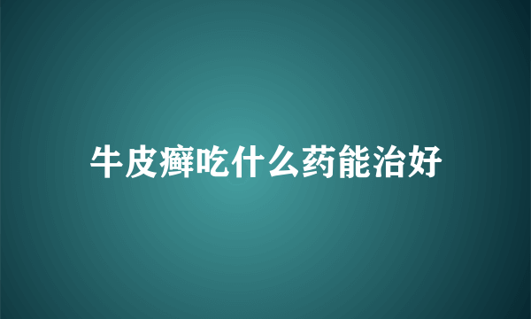 牛皮癣吃什么药能治好