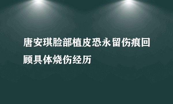 唐安琪脸部植皮恐永留伤痕回顾具体烧伤经历