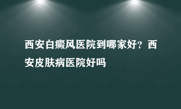 西安白癜风医院到哪家好？西安皮肤病医院好吗