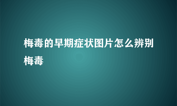 梅毒的早期症状图片怎么辨别梅毒
