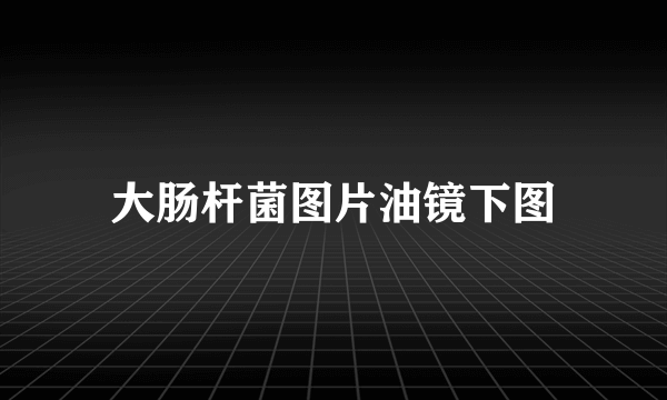 大肠杆菌图片油镜下图