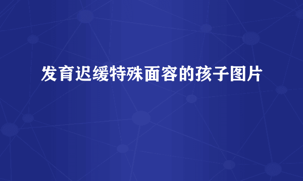 发育迟缓特殊面容的孩子图片