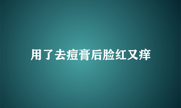 用了去痘膏后脸红又痒
